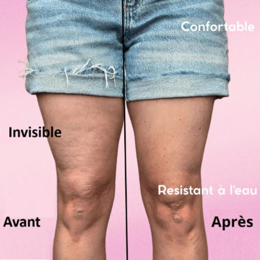 Foggiawoman™ – Patchs Raffermissants invisibles